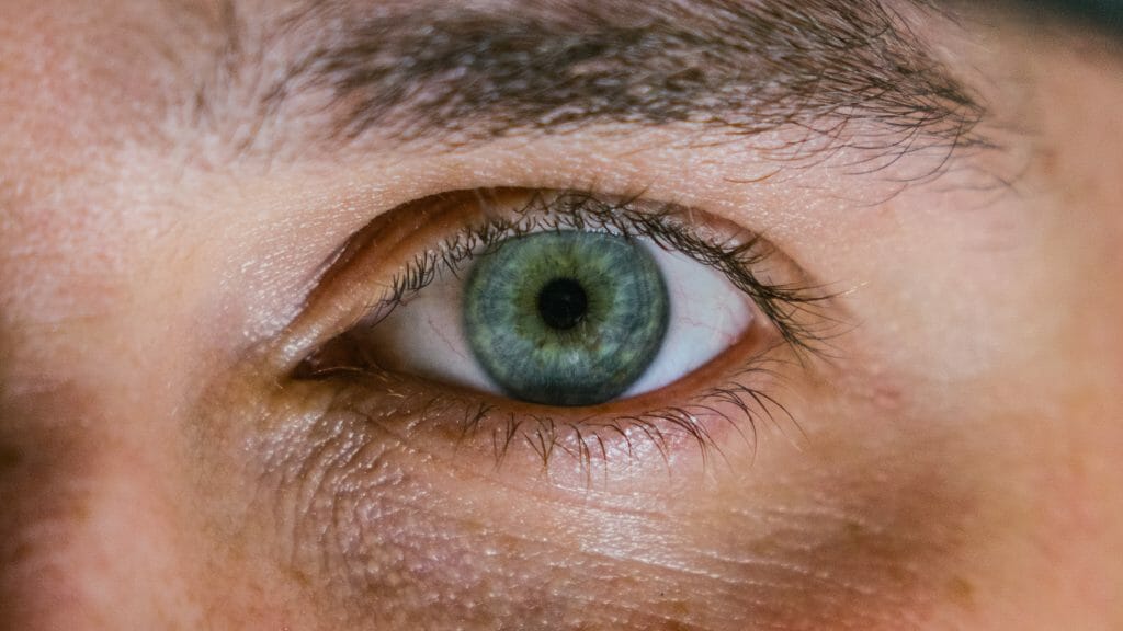 Best Swollen Eyelid Treatment- Theralife 1 ectropion