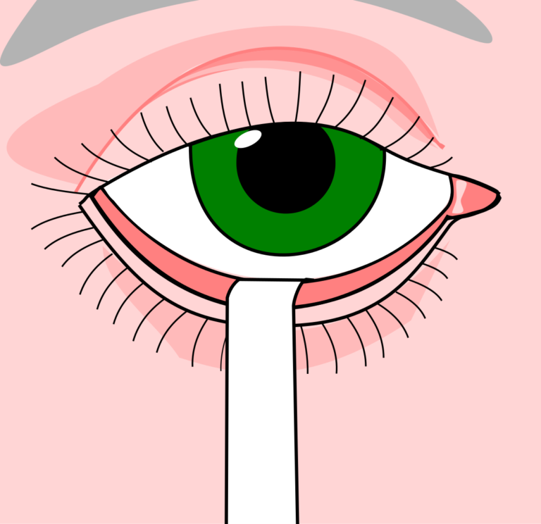 Schirmer Test for dry eyes