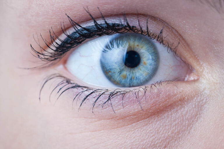 blepharitis treatments