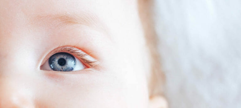 chalazion treatment