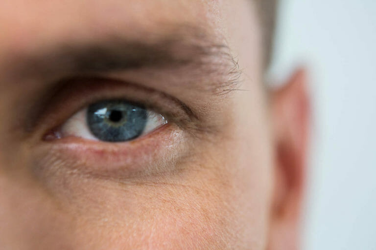 morning eye discharge
