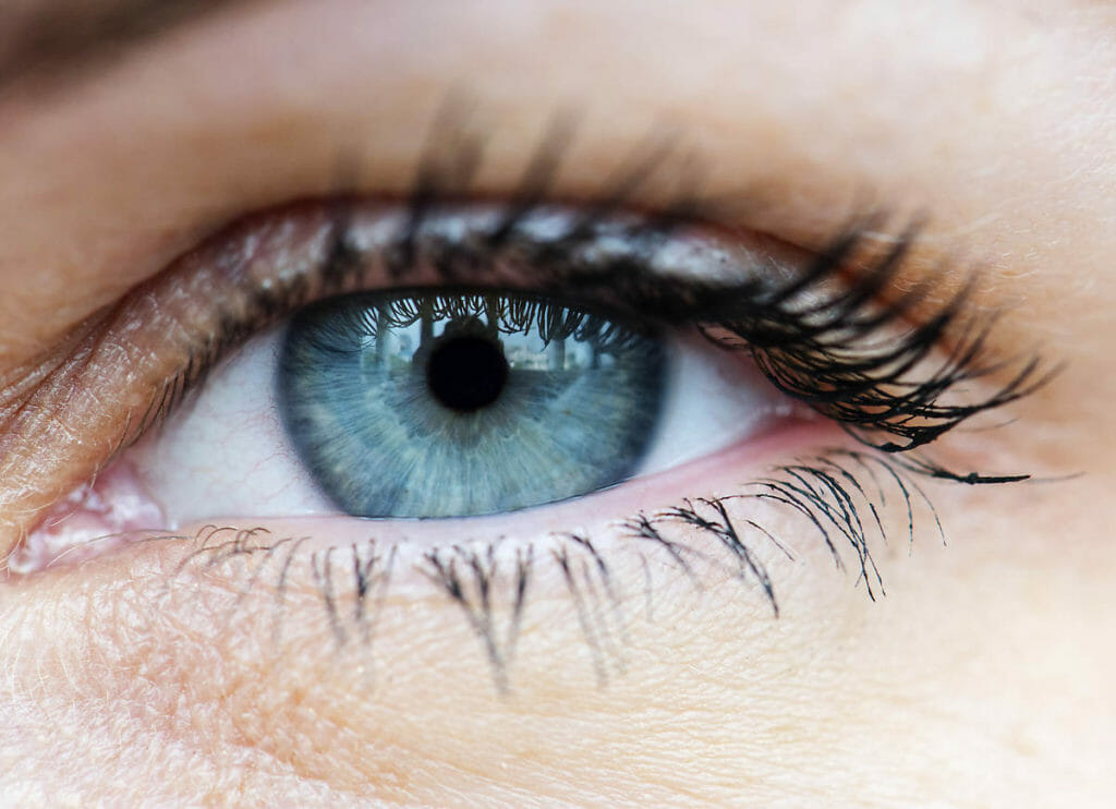 What Causes Dry Eyes and What Are Symptoms of Dry Eyes? 1 dry eyes & Ocular Rosacea