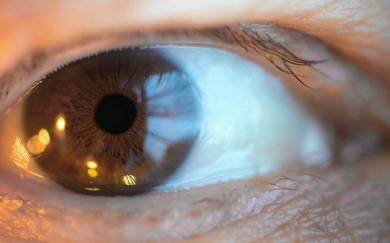 Uveitis Treatments