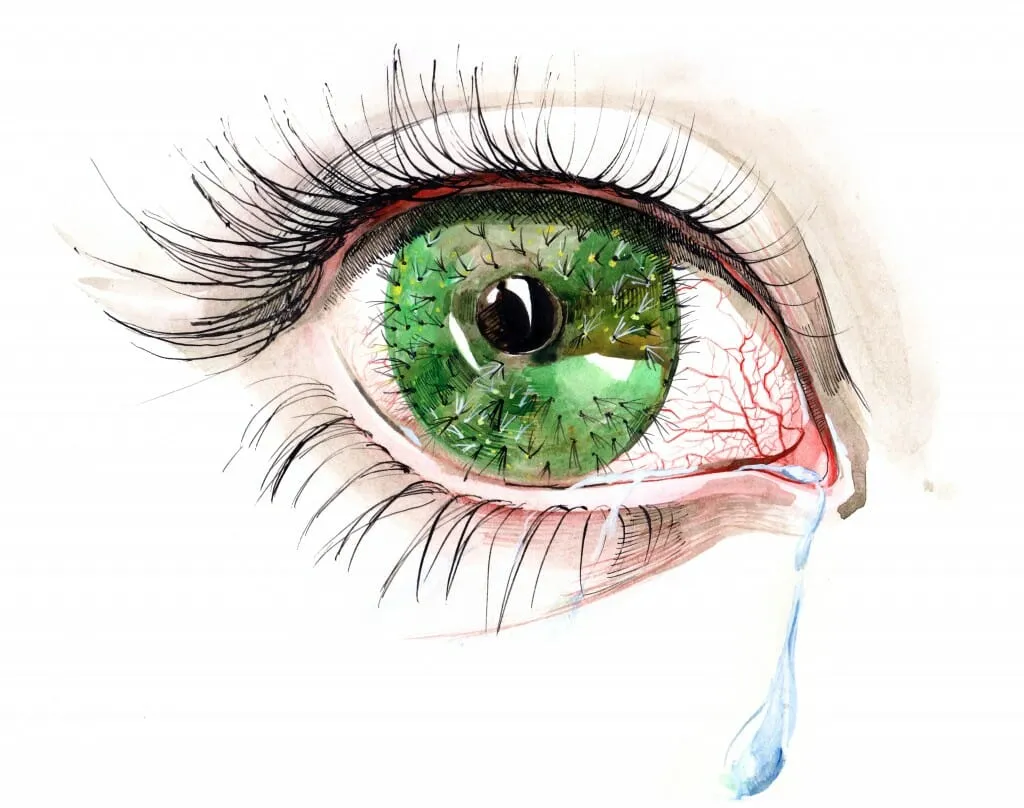 Identify and Treat Dry Eye Syndrome with TheraLife Now 1 dry eye syndrome