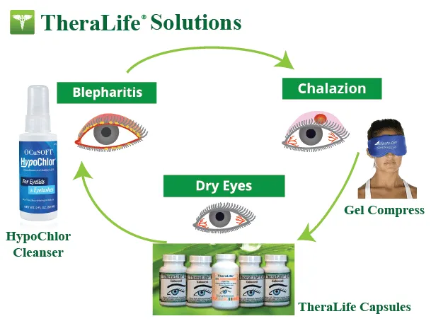 Treating a Chalazion (Chalazia) 3 TheraLife Solution Chalazion v2