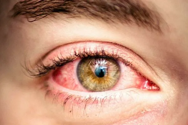 Dry Eyes At Night